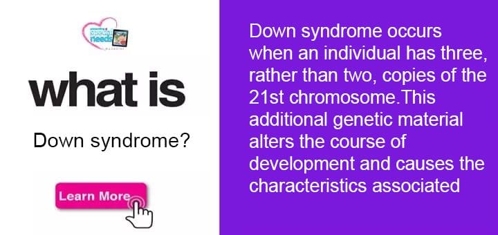 What is Down syndrome – Parenting Special Needs Magazine